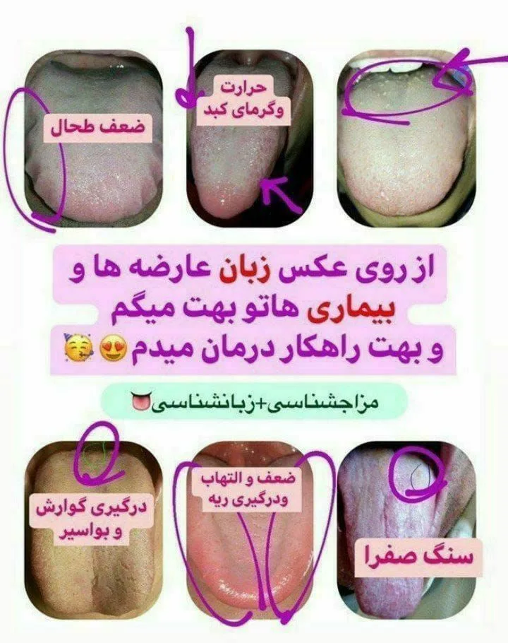 طب سنتی آیا میدانید با پاکسازی و اصلاح مزاج می‌توانید به اندام مناسب برسید