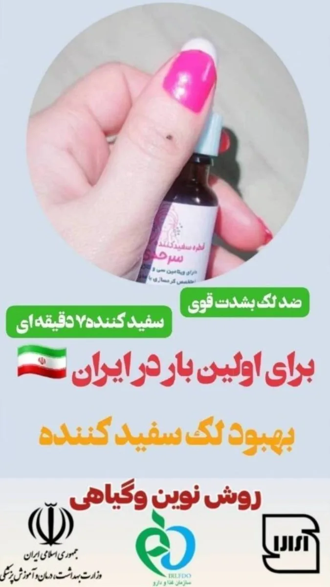 سفید کننده ضد لک  قطره فریزری
